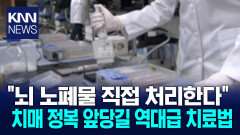 치매 원인 노폐물 직접 제거 유전자 뇌세포 치료 등장 / KNN
