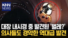 내시경 중 ′무당벌레′ 발견?! ＂이게 왜 여기서..＂ 단체 경악 / KNN