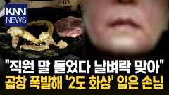 ＂곱 안 빠지게 실로 묶으세요＂ 직원 말 들었다 ′2도 화상′ 날벼락? / KNN