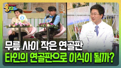 [건강버라이어티 올리브] 무릎 사이 작은 연골판 타인의 연골판으로 이식이 될까?