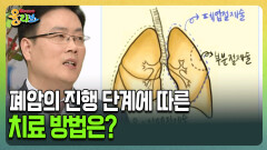 [건강버라이어티 올리브] 폐암의 진행 단계에 따른 치료 방법은?