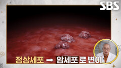 만성염증 쌓이면 암 유발하는 치명적인 이유!