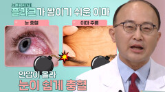 눈 충혈·이마 주름 증상, ‘혈관 석회화’의 위험 신호 (닥터필생기)