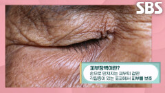 자외선 차단 소홀해지는 가을에 ‘피부장벽’ 세워야 하는 이유