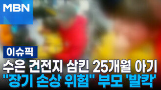 수은 건전지 삼킨 25개월 아기…＂장기 손상 위험＂ 부모 \