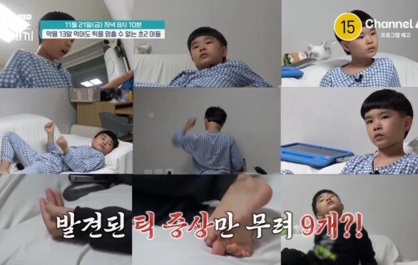 [예고] 전신에서 나타나는 \