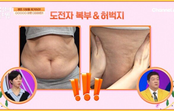 노후된 지방으로 불리는 \