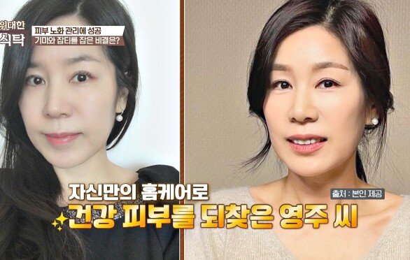 피부 노화 관리 성공! 기미·잡티 막아주는 \