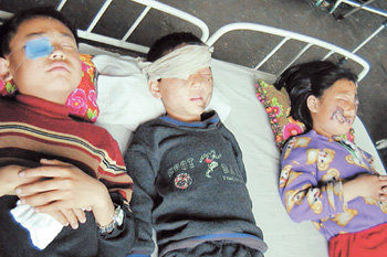 Children Patients in Pain