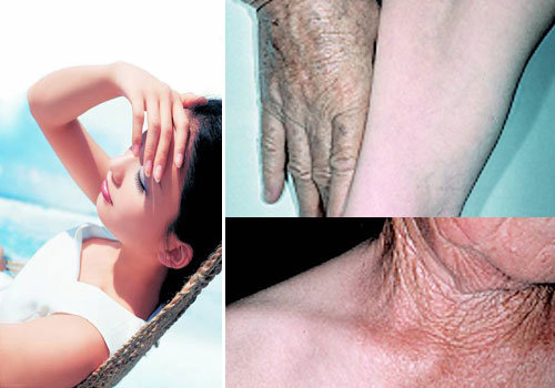 UV Aging