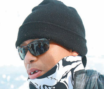 Tiger Woods loses tooth in accident