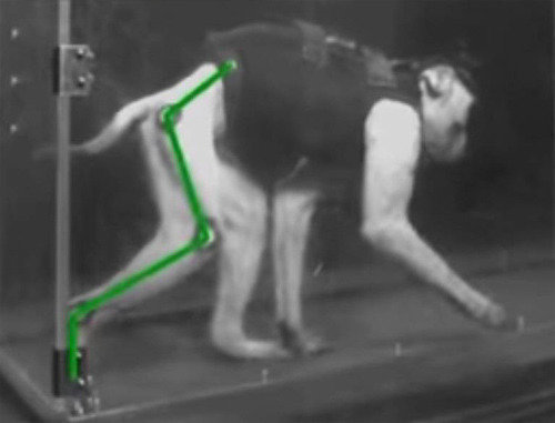 뇌 임플란트, 하반신마비 치료