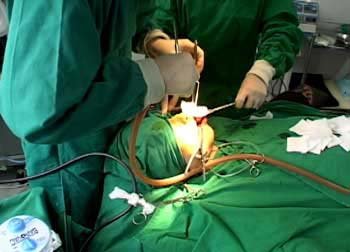 코수술만7번성형중독의폐해밝힌다