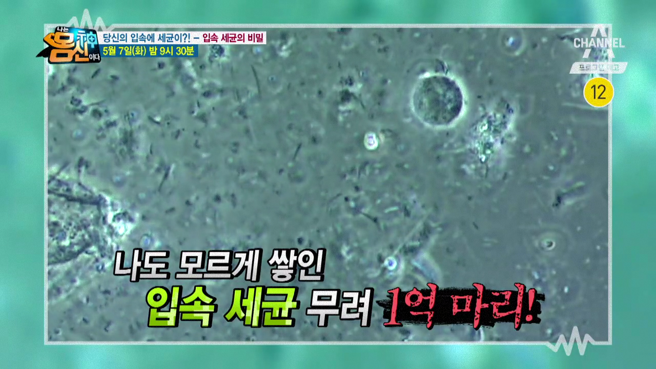 [예고] 나도 모르게 쌓인 입속 세균이 무려 1억 마리?!