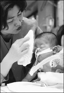 태어나면서부터 폐기형으로 패혈증 앓는 11개월 된 홍준수군의 사연