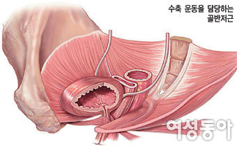 “케겔 운동으로 요실금과 골반 질환 예방하세요”