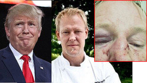 ‘트럼프 닮아서’ 폭행 당한 백인 남성