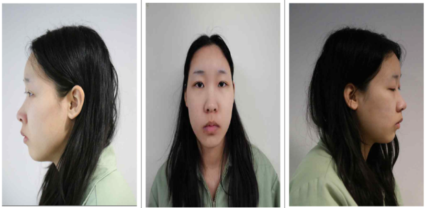 Police release identity in drugged drink killing