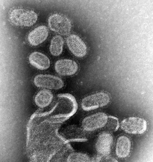 인플루엔자 바이러스를 10만 배 확대한 현미경 사진. [미국질병통제예방센터 제공]