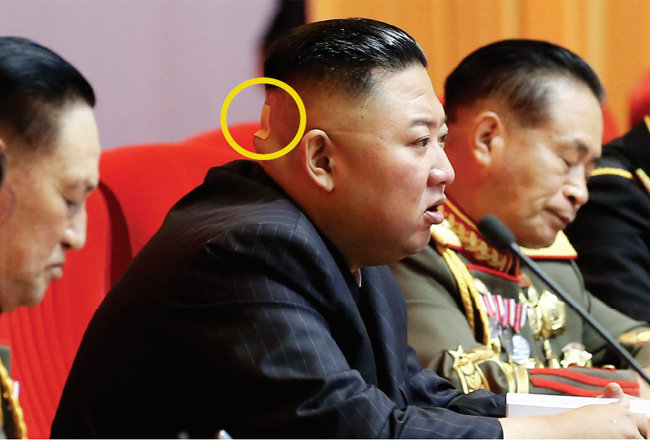7월 30일 북한 노동신문이 공개한 김정은 국무위원장의 사진. 뒤통수에 파스, 밴드 등으로 추정되는 것(원 안)을 붙인 모습이 눈에 띈다. [ 
