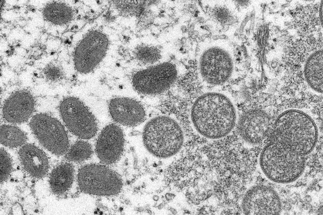 미국 질병통제예방센터가 공개한 원숭이두창 바이러스. [AP/뉴시스]