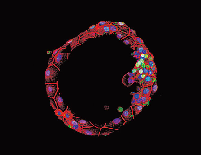 알리 브리반루 미국 록펠러대 연구팀이 진행한 합성 인간 배아 연구에서 배양 6일 차에 세포 수백 개가 속이 빈 구 형태의 배반포를 형성했다. [록펠러대 제공]
