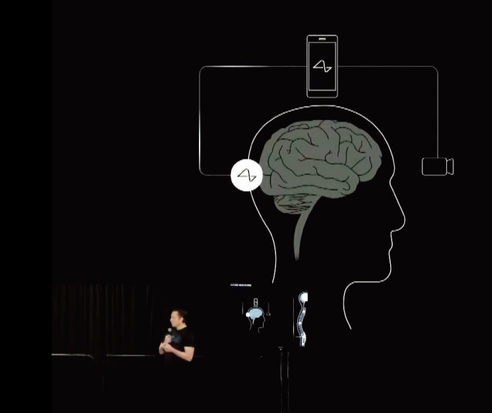 일론 머스크 테슬라 최고경영자(CEO)가 설립한 뇌신경과학 스타트업 뉴럴링크가 사람 뇌에 칩을 이식하는 임상시험에 성공했다고 밝혔다. [뉴럴링크 유튜브 캡쳐]