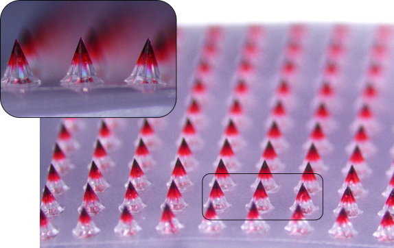 대웅테라퓨틱스가 개발한 마이크로니들 패치. 대웅제약 제공