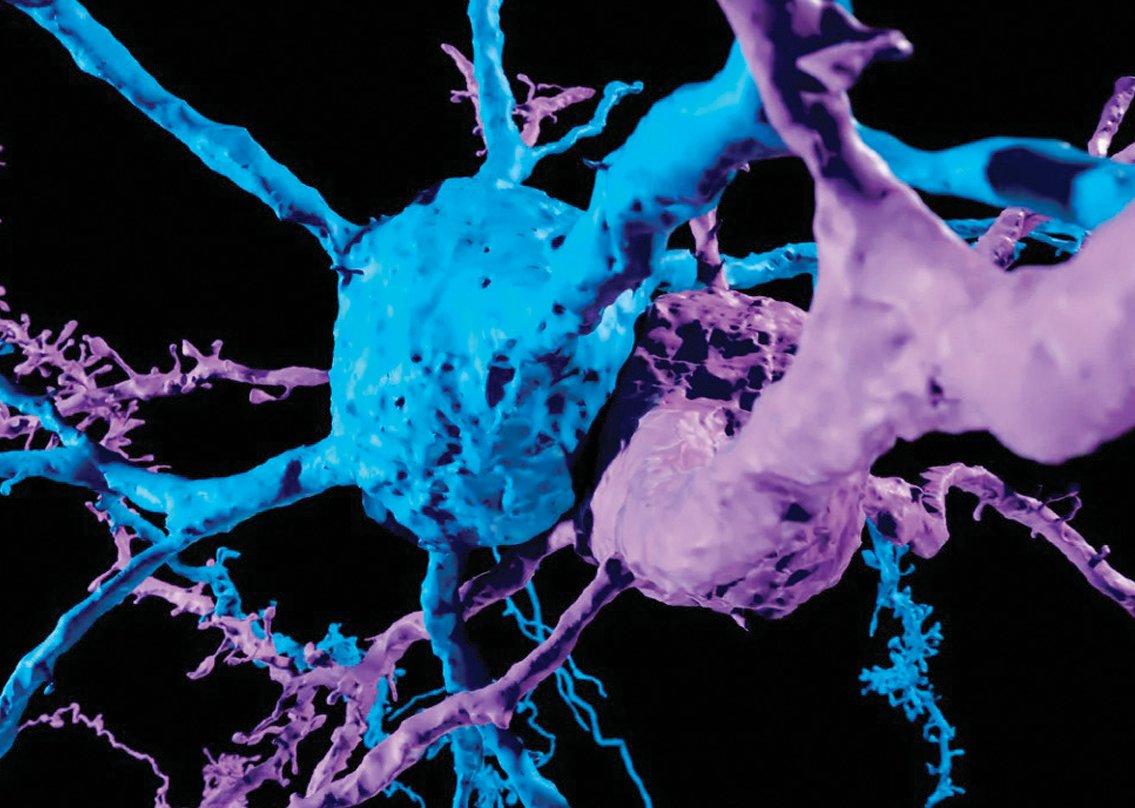 쥐 뇌에서 억제성 뉴런(파란색)과 흥분성 뉴런(보라색)의 연결 구조를 3차원으로 재구성한 모습. 미국 프레스턴대 제공