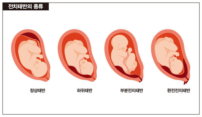 [이미지 제공 고려대학교의료원]