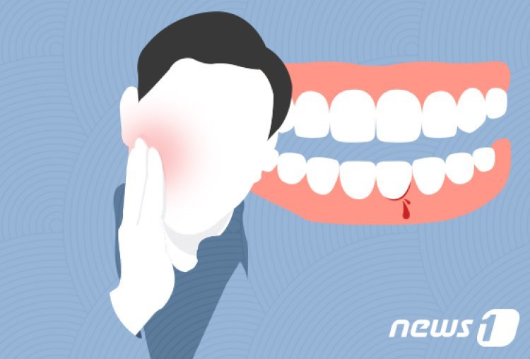 단순 잇몸 염증인 줄 알았는데…8주 지나도 안 낫는다면 ‘이것’ 가능성