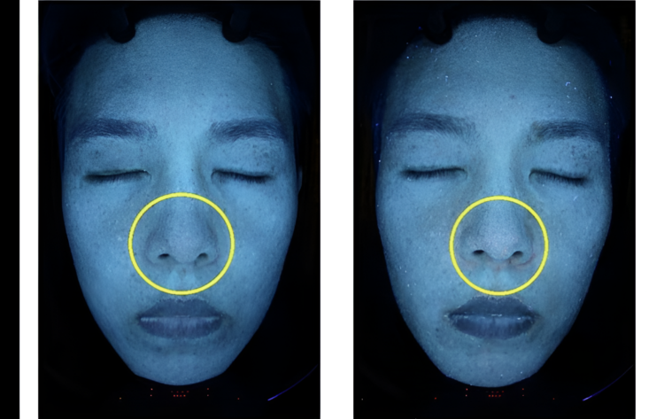 “7일 만에 피부 나이 ‘5살’ 폭삭” 피부과 의사, 직접 실험한 결과는?