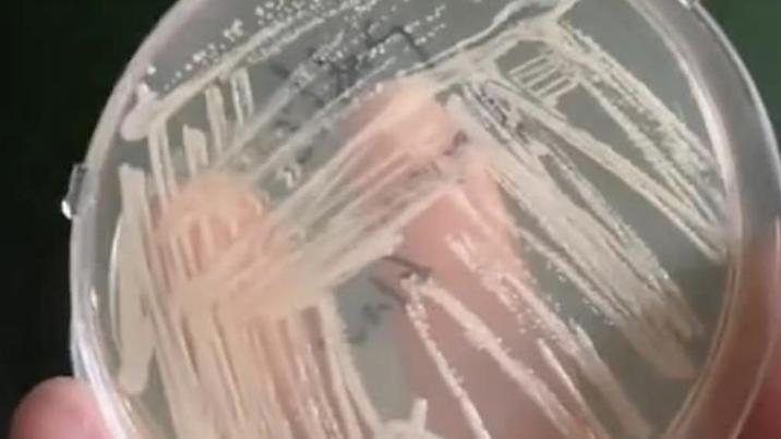 슬리퍼 없이 샤워 금물…헬스장 바닥에서 세균 폭발