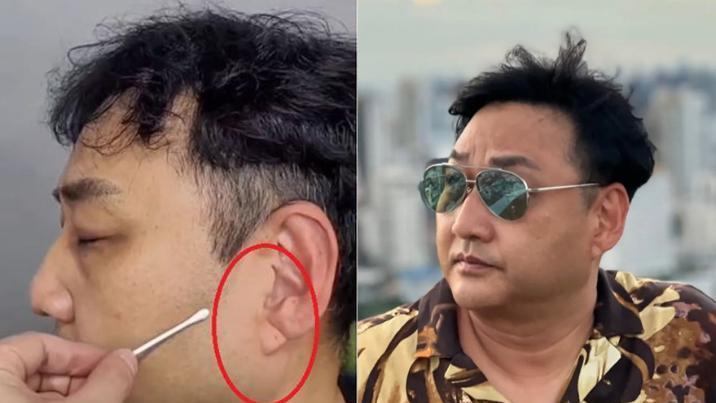 쓰러진 김수용 귓불에 깊은 사선 주름…심혈관 이상 전조?