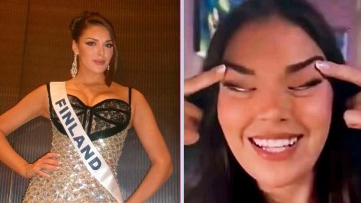 “두통에 관자놀이 문지른 것”…‘눈 찢기’ 미스 핀란드, 왕관 박탈
