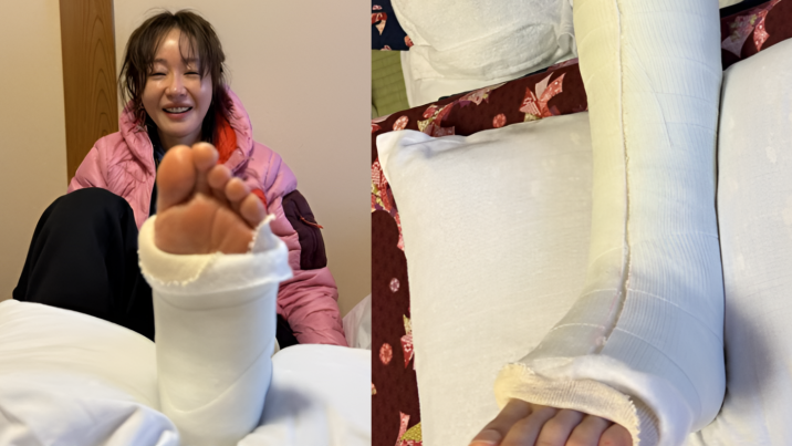 “맨홀에 끼여 발목 뼈 산산조각” 엄지원, 日 여행중 긴급수술