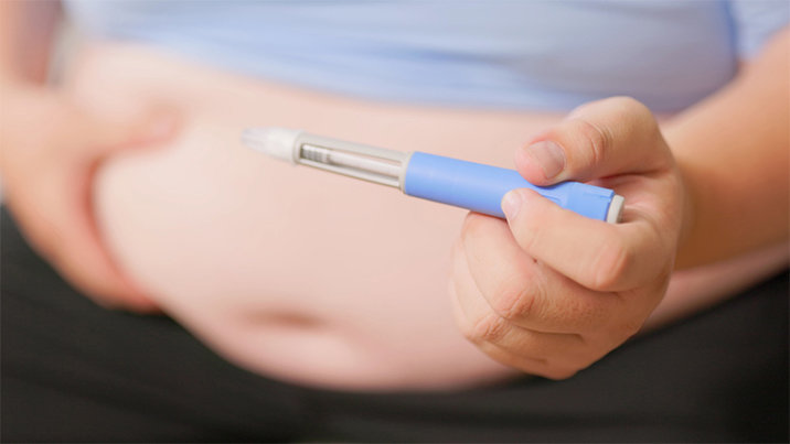 비만치료제의 그늘…골다공증 30%, 통풍 12% 위험 높인다