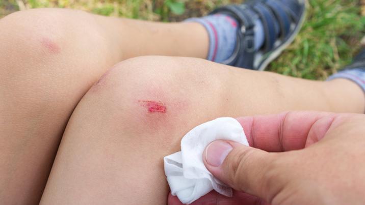 오염된 물티슈 썼다가 “6명 사망”…英 62명 세균 감염