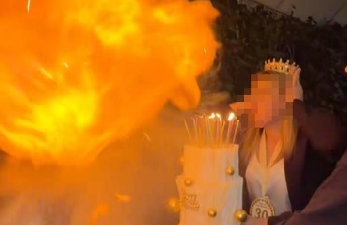 “생일날 얼굴이 화염에”…‘불 뿜기’ 챌린지 하다가 중화상