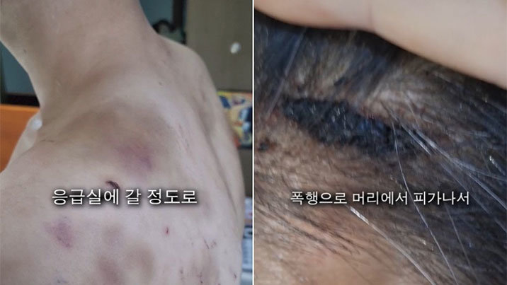 “다락방 가두고 요강 쓰라고…” 직원 감금·폭행한 중국집 사장