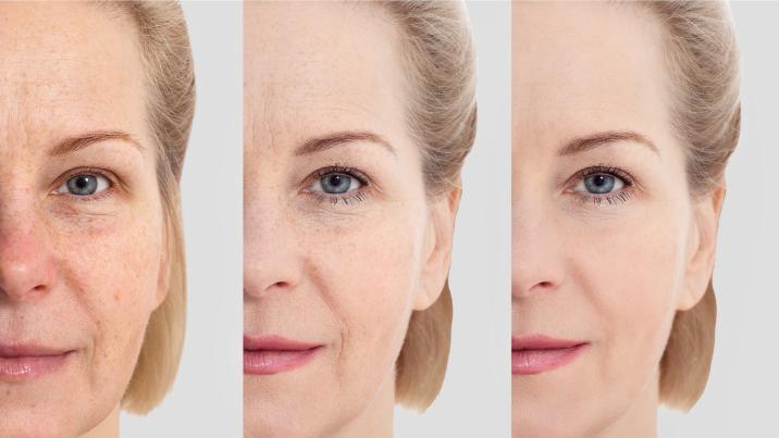 “노화 시력 되돌린다”…오메가3 아닌 ‘이 지방산’ 주목