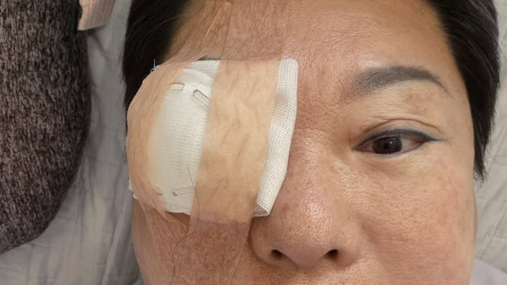양희은 “각막이식 수술…난 아파야만 쉬는 여자인가”