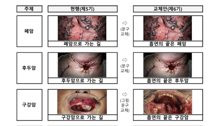 “흡연의 끝은 폐암”…담뱃갑 문구 더 직관적으로 바뀐다