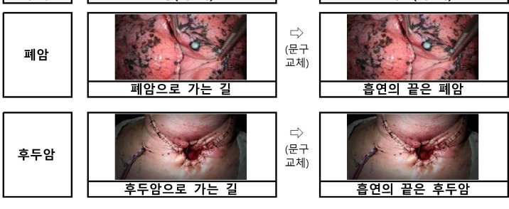 “흡연의 끝은 폐암”… 담뱃갑 경고 더 세진다