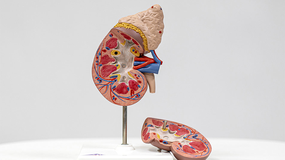 살찌고 지방간 있는 2030, 신장암 위험 2배 이상 높다