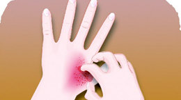 임금님의 가려움증[이상곤의 실록한의학]〈143〉