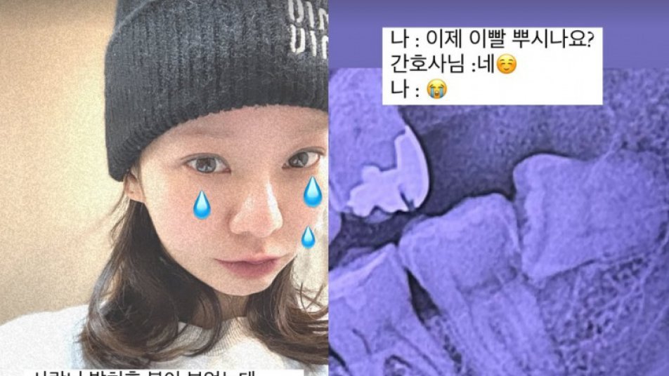 맹승지, 사랑니 빼고 예뻐졌다?…“원래 얼굴보다 괜찮은 듯”