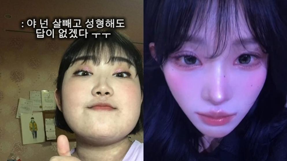 “살빼고 성형해도 답 없겠다”, 실천으로 반박한 최준희…같은 사람 맞아?