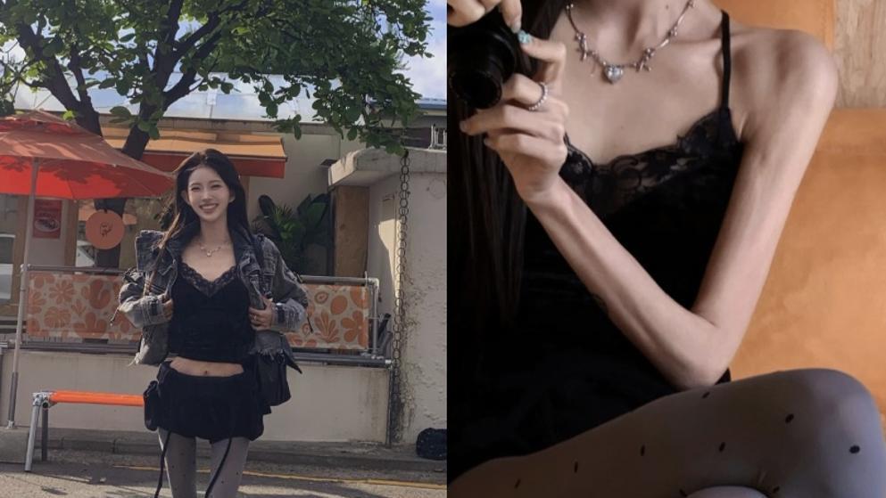 최준희, 살가죽만 남은 ‘극세사’ 팔 자랑