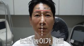리프팅 시술한 59살 지석진 “효과 이 정도였냐”